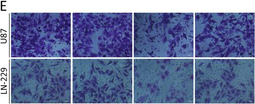 Correction to “P68 RNA helicase promotes invasion of glioma cells through negatively regulating DUSP5”