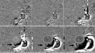 Tracing shock waves: type II radio emission on 27th of September 2001