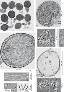 Semibalanus balanoides (L.) and Balanus crenatus Bruguière (Balanidae) Are Intermediate Hosts of Fimbriarioides intermedia (Fuhrmann, 1913) and Two Species of the Genus Microsomacanthus (Cestoda: Hymenolepidae), Parasites of Sea Ducks from the Atlantic Sector of the Arctic and Northern Pacific