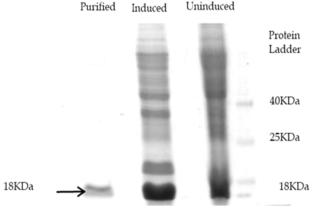 Computational and Experimental Approaches Towards Understanding the Role of ATG8 in Autophagy: A Therapeutic Paradigm in Leishmaniasis