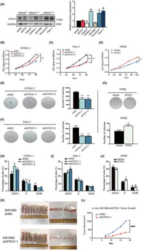 The molecular mechanism underlying KRAS regulation on STK31 expression in pancreatic ductal adenocarcinoma