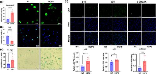 Cardiac and skeletal muscle manifestations in the G608G mouse model of Hutchinson-Gilford progeria syndrome