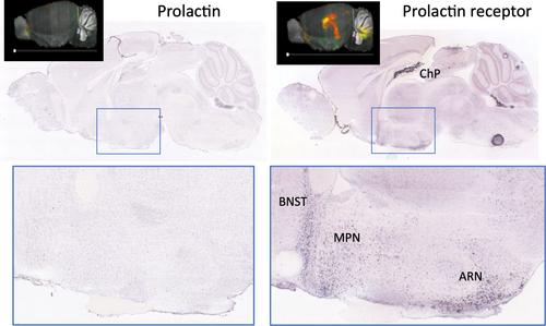 Does the brain make prolactin?