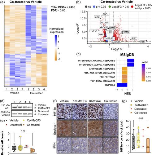 A vitamin D-based strategy overcomes chemoresistance in prostate cancer