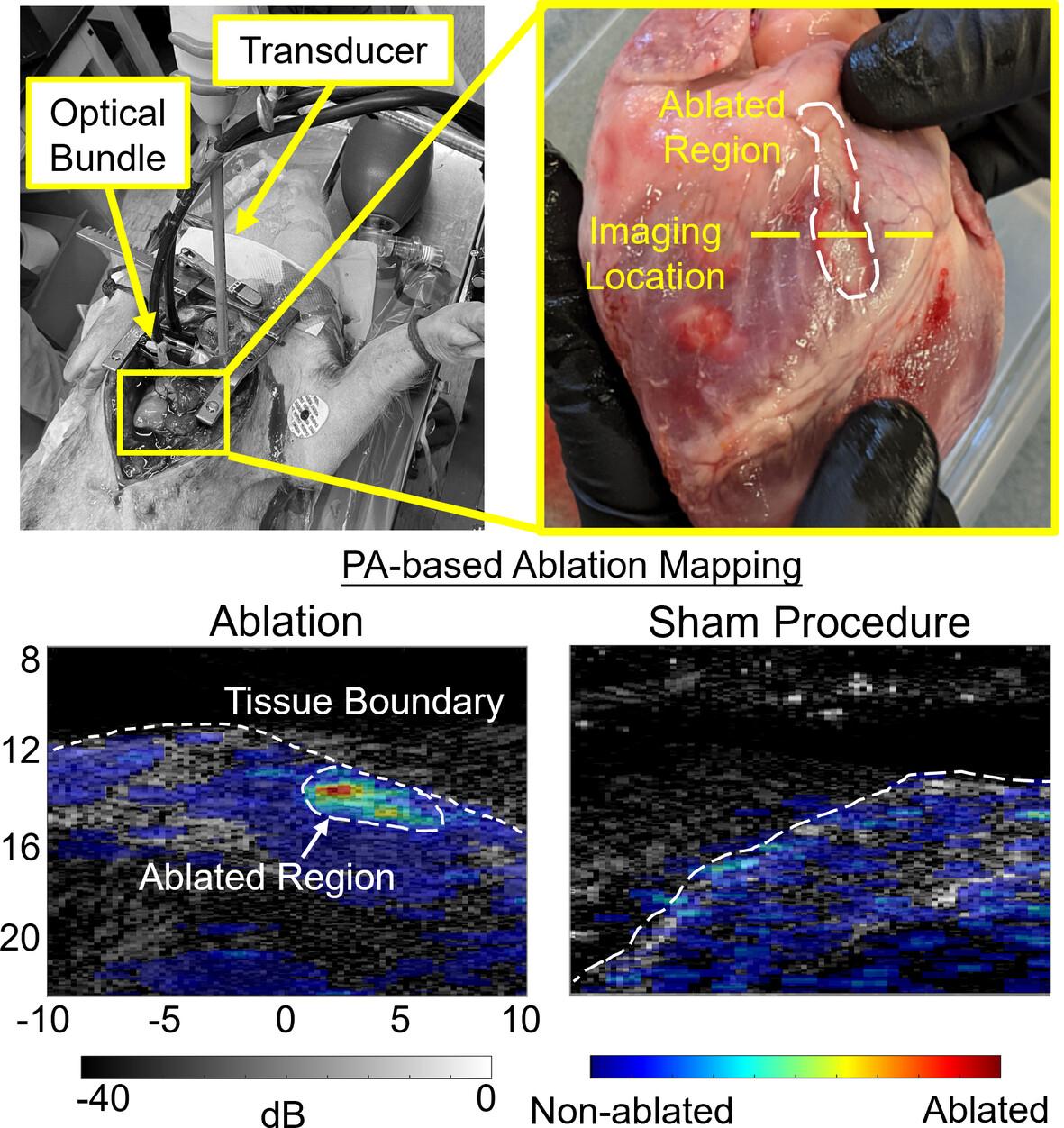 Cardiac-gated spectroscopic photoacoustic imaging for ablation-induced necrotic lesion visualization