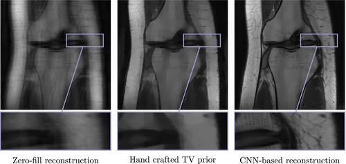 Neural-network-based regularization methods for inverse problems in imaging