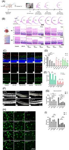 Therapeutic effects of tetrahedral framework nucleic acids and tFNAs-miR22 on retinal ischemia/reperfusion injury