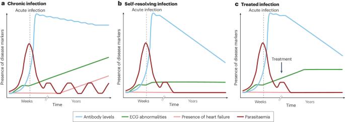 Cardiac involvement in Chagas disease and African trypanosomiasis