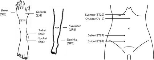 Significance of acupuncture treatment for medical staff with low back pain: A case report