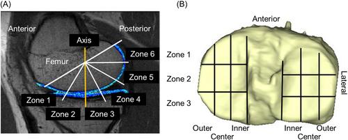 Reliability and changes in knee cartilage T2 relaxation time from 6 to 24 months after anatomic anterior cruciate ligament reconstruction