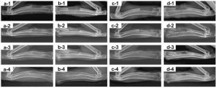 Synergizing additive manufacturing and machine learning for advanced hydroxyapatite scaffold design in bone regeneration