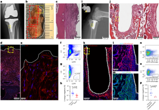 Prevention and treatment of peri-implant fibrosis by functionally inhibiting skeletal cells expressing the leptin receptor