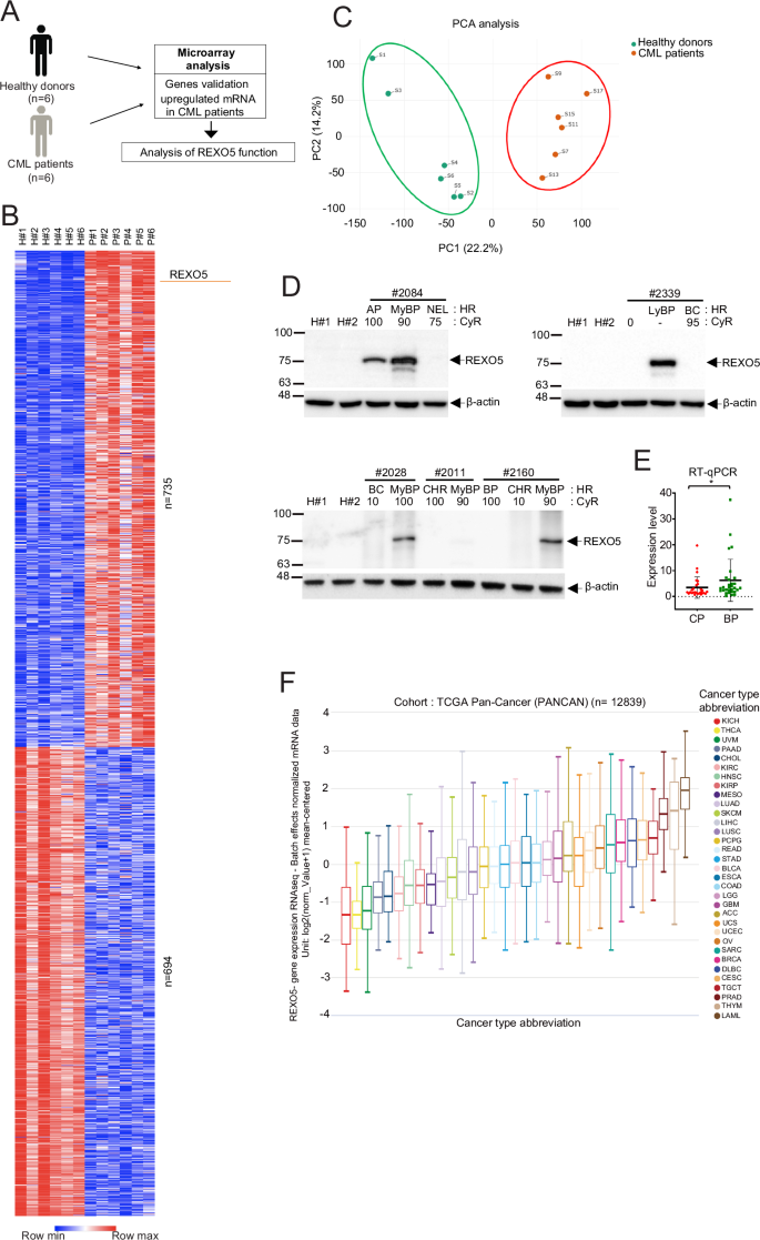 REXO5 promotes genomic integrity through regulating R-loop using its exonuclease activity