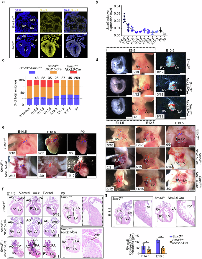 SMC3 contributes to heart development by regulating super-enhancer associated genes