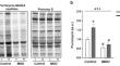 Methylglyoxal reduces resistance exercise-induced protein synthesis and anabolic signaling in rat tibialis anterior muscle.