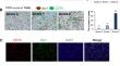 Potential protumor function of CD74 in clear cell renal cell carcinoma.