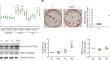 Osteogenic effect of an adiponectin-derived short peptide that rebalances bone remodeling: a potential disease-modifying approach for postmenopausal osteoporosis therapy.