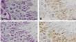 Stage-specific expression of Toll-like receptors in the seminiferous epithelium of mouse testis.