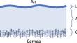 On modeling tear breakup dynamics with a nematic lipid layer