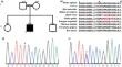 A novel variant in the GNE gene in a Malian patient presenting with distal myopathy.