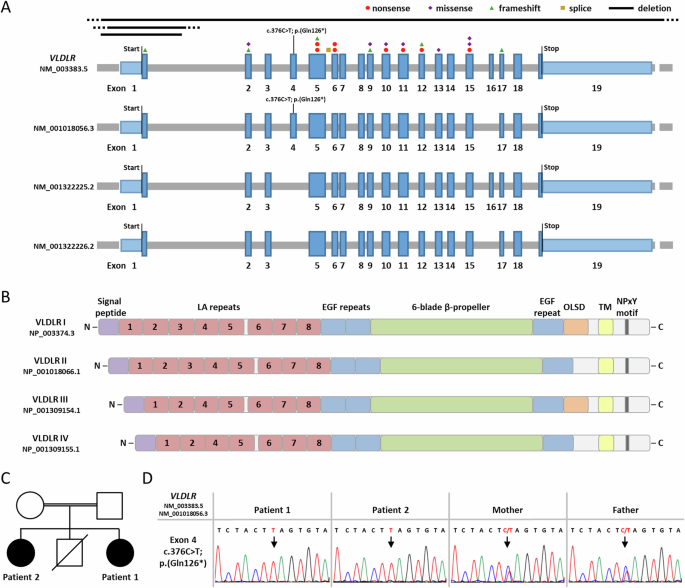 A homozygous nonsense variant in the alternatively spliced VLDLR exon 4 causes a neurodevelopmental disorder without features of VLDLR cerebellar hypoplasia.