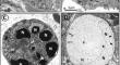 The role of NETosis in heart failure.