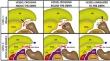 Neurovascular crossing patterns between leash of Henry and deep branch of radial nerve: implications for neurointervention and diagnostic imaging.