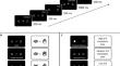 Erroneous saccade co-execution during manual action control is independent of oculomotor stimulus-response translation ease.