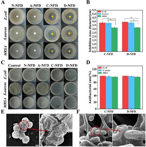 Correction to "Dual-Drug-Loaded Core-Shell Electrospun Nanofiber Dressing for Deep Burns".