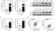 PSIP1 promotes gefitinib resistance in lung adenocarcinoma by inducing the expression of WASF3 and its downstream ITGB3/AKT signaling.