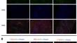 Profiling dendritic cells subsets in renal tissue of patients with crescentic glomerulonephritis.