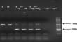 The relationship between ACE gene insertion/deletion polymorphism and diabetes retinopathy patients with diabetes type 1