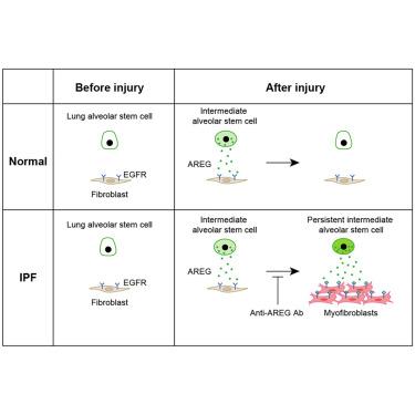 Sustained amphiregulin expression in intermediate alveolar stem cells drives progressive fibrosis