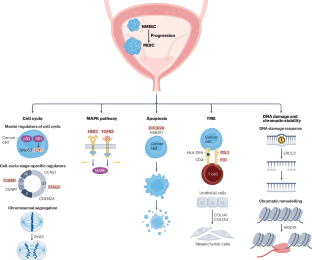 Molecular biomarkers of progression in non-muscle-invasive bladder cancer — beyond conventional risk stratification