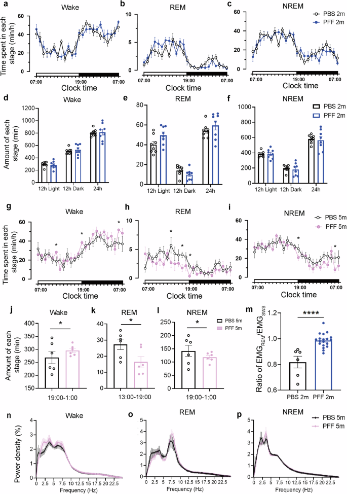 GBA-AAV mitigates sleep disruptions and motor deficits in mice with REM sleep behavior disorder.