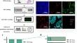 Spatial cell interplay networks of regulatory T cells predict recurrence in patients with operable non-small cell lung cancer.