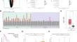 Knockdown of WISP1/DKK1 restrains phenotypic plasticity in esophageal squamous cell carcinoma by suppressing epithelial-mesenchymal transition and stemness.