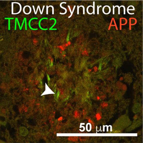 Transmembrane and coiled-coil 2 associates with Alzheimer's disease pathology in the human brain.