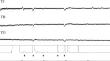 Electrophysiological Responses of Trissolcus japonicus, T. basalis, and T. oenone (Hymenoptera: Scelionidae) to Volatile Compounds Associated with New Zealand Stink Bugs (Hemiptera: Pentatomidae).