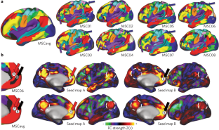 The promise of precision functional mapping for neuroimaging in psychiatry.