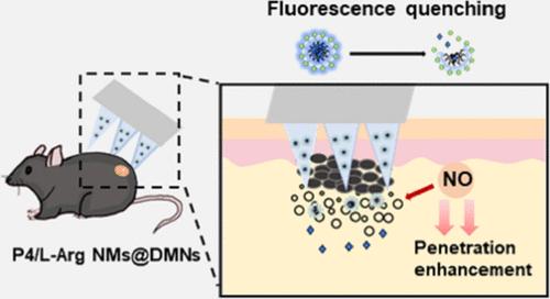 Biological Fate Tracking of Nitric Oxide-Propelled Microneedle Delivery System Using an Aggregation-Caused Quenching Probe.