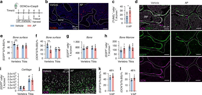 Induction of osteoblast apoptosis stimulates macrophage efferocytosis and paradoxical bone formation