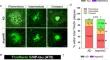 Enhanced microglial dynamics and a paucity of tau seeding in the amyloid plaque microenvironment contribute to cognitive resilience in Alzheimer’s disease