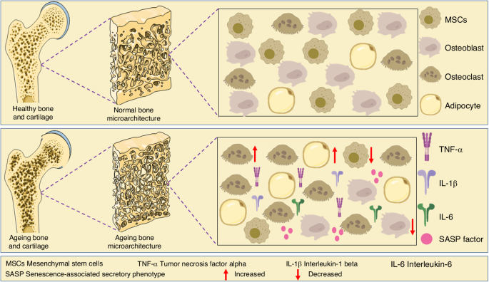 Ageing-related bone and immunity changes: insights into the complex interplay between the skeleton and the immune system