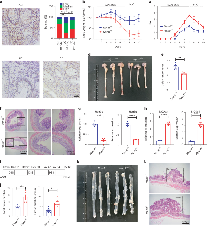 Nucleophosmin 1 promotes mucosal immunity by supporting mitochondrial oxidative phosphorylation and ILC3 activity