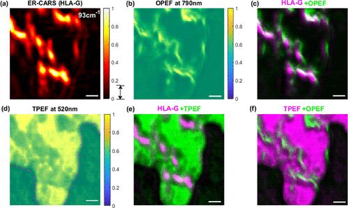 Electronic-Resonance Coherent Anti-Stokes Raman Scattering Spectroscopy and Microscopy
