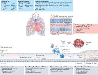 Mechanisms and treatment of pulmonary arterial hypertension