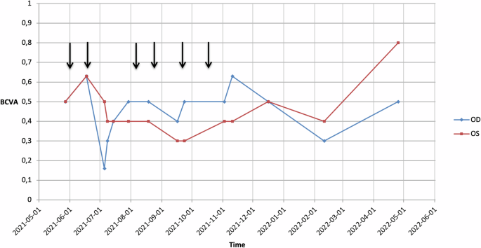 Dynamics of microcyst-like epithelial changes associated with Belantamab mafodotin therapy in a patient with multiple myeloma-a case report.