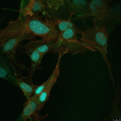 Bright New Resources for Syphilis Research: Genetically Encoded Fluorescent Tags for Treponema pallidum and Sf1Ep Cells.