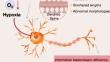 Cerebral Hypoxia-Induced Molecular Alterations and Their Impact on the Physiology of Neurons and Dendritic Spines: A Comprehensive Review.